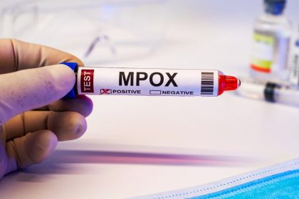 Govt steps into action as Pakistan’s first mpox patient goes missing